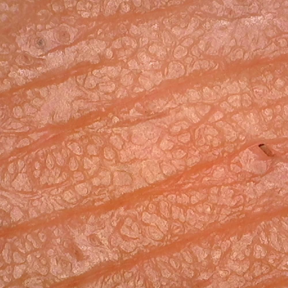 invecchiamento della pelle del viso